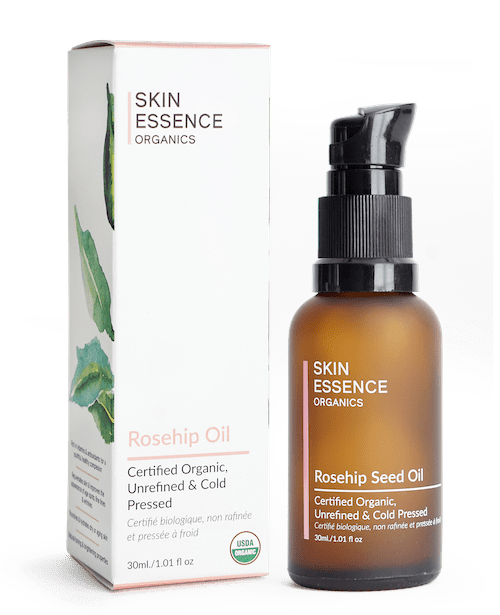 Skin Essence Organics Rosehip Seed Oil (Cold-Pressed, Unrefined, Certified Organic)